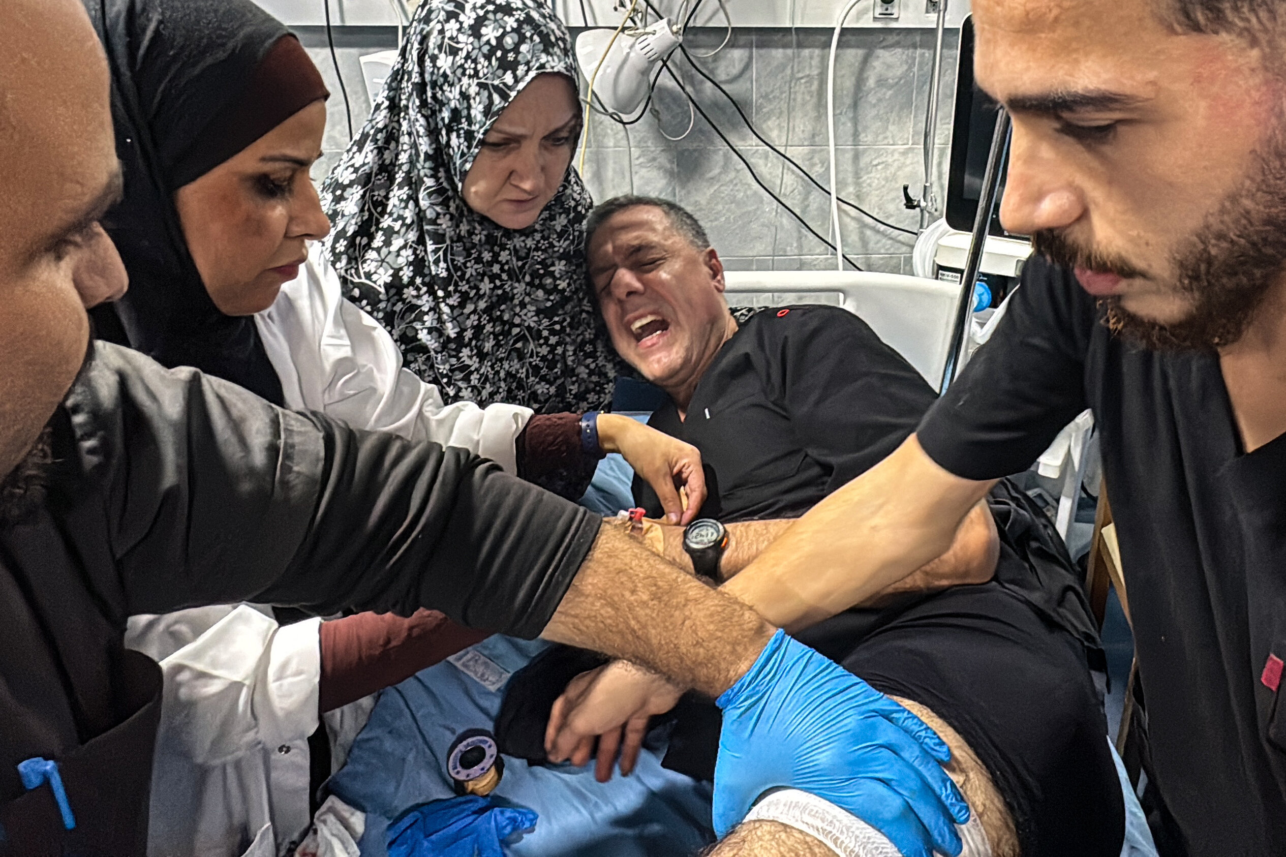 Dr. Hussam Abu Safiya, director of the Kamal Adwan Hospital, is treated by colleagues for his injuries following an Israeli strike. 