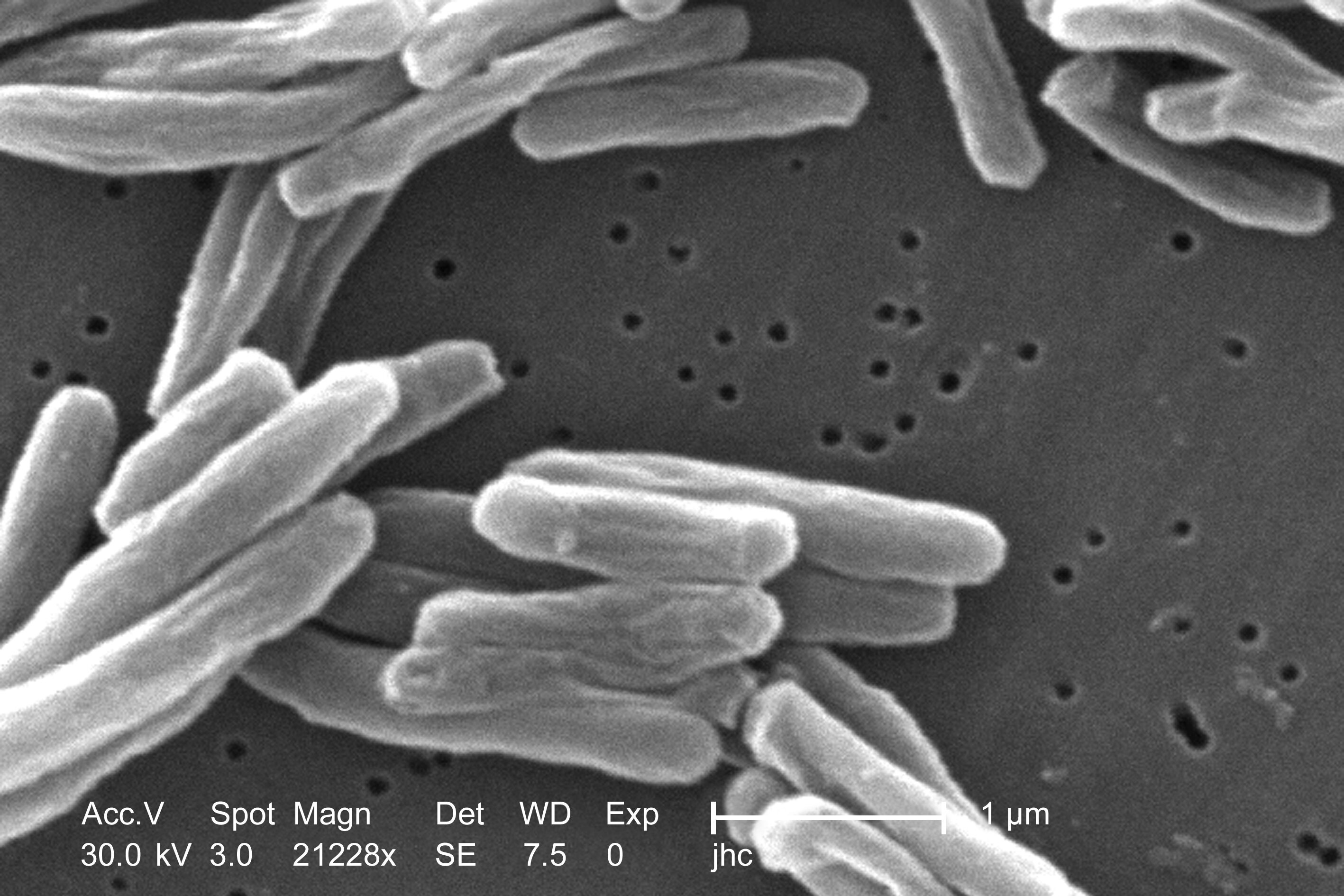 Mycobacterium tuberculosis bacteria, which causes the disease tuberculosis, is seen through a microscope.