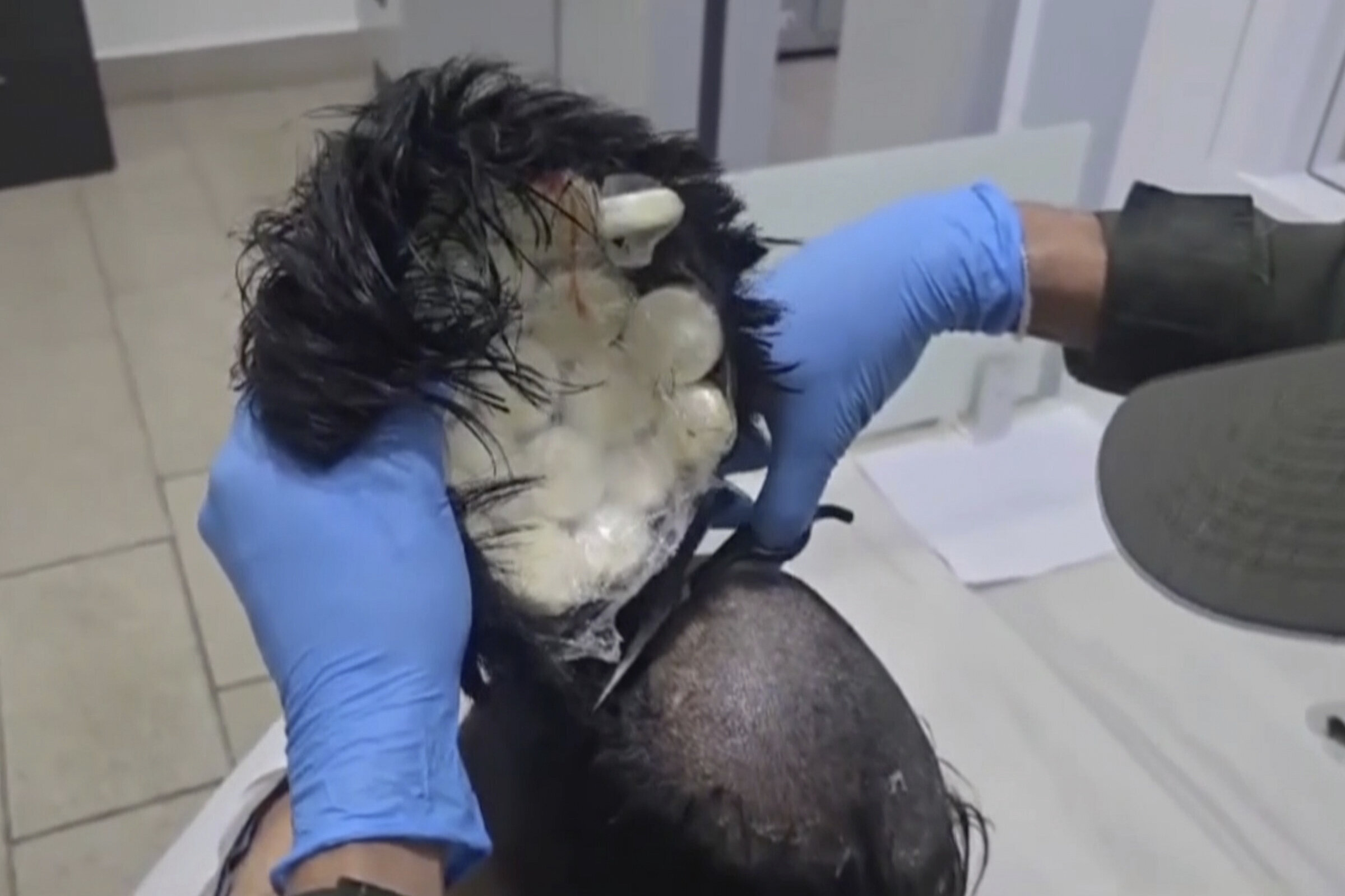 Colombian police apprehended a 40-year-old man attempting to smuggle several bags of cocaine concealed beneath a meticulously attached toupee.