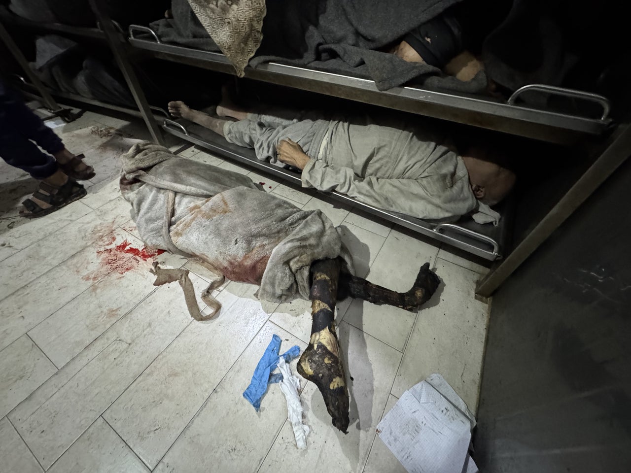 A person's charred body at the morgue of Nasser Hospital in Khan Younis is placed with other bodies of Palestinians who were killed by Israeli airstrikes on March 18, 2025.